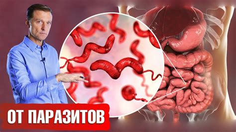 Лечение глистов у человека и опасности самолечения